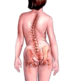 Patología del sistema musculoesquelético