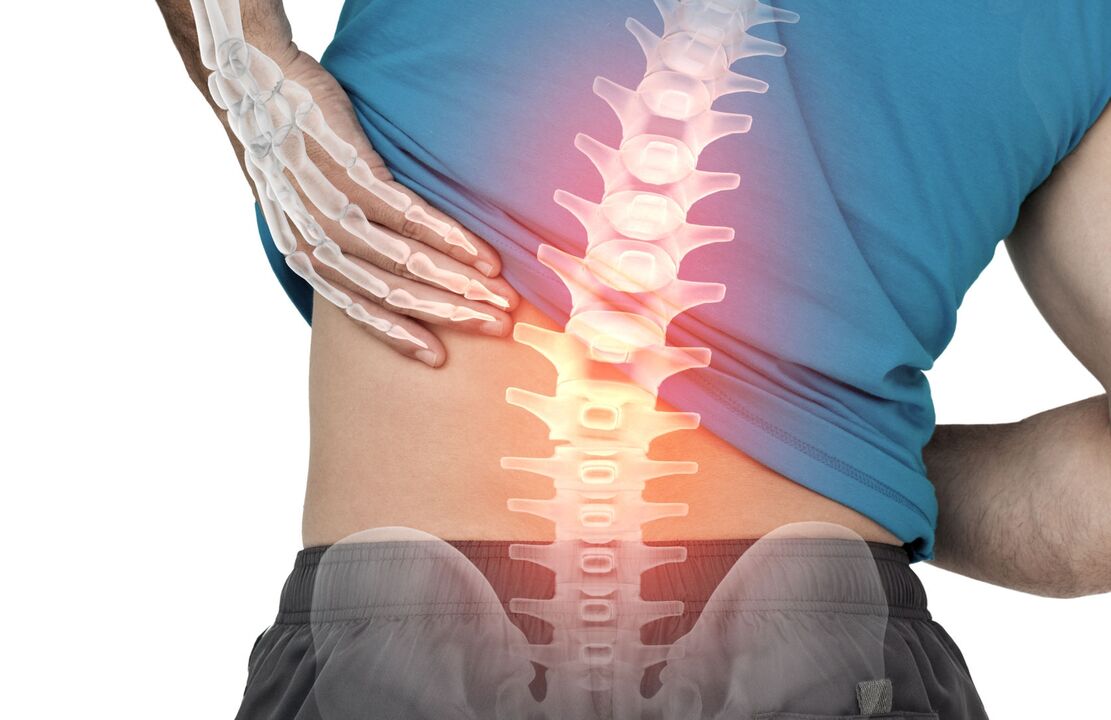 El peligro de la ostecondrosis de la lumbar