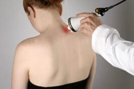 Tratamiento de la osteocondrosis cervical con terapia con láser